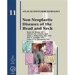 Non-Neoplastic Diseases of the Head and Neck - 9781933477374