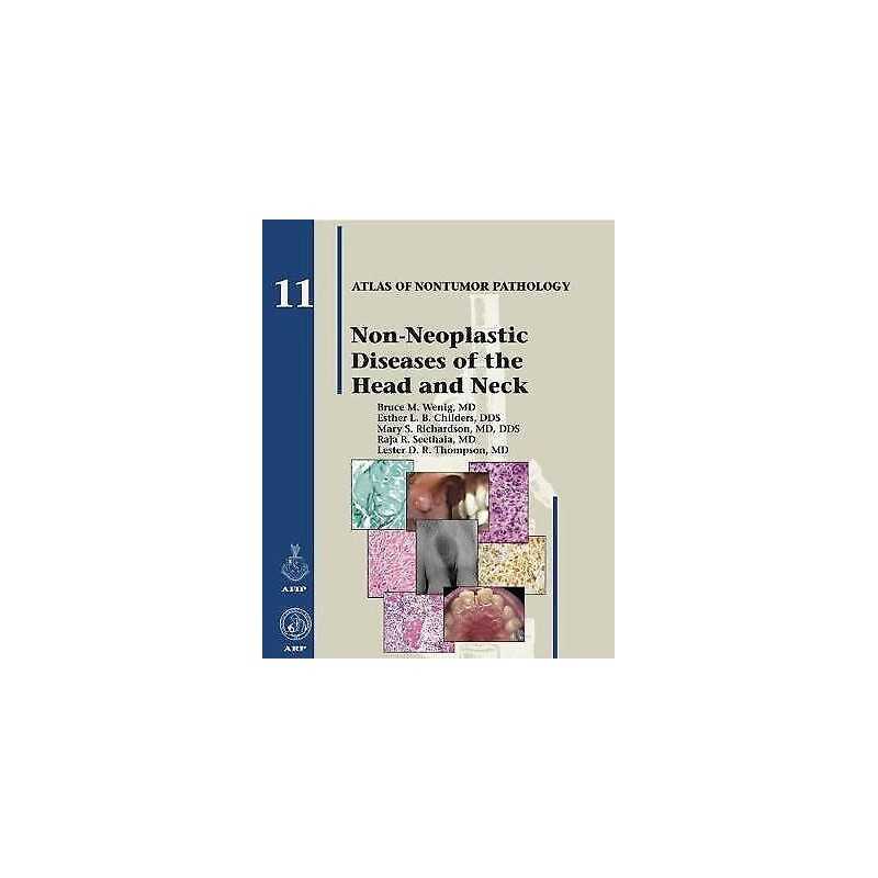 Non-Neoplastic Diseases of the Head and Neck - 9781933477374