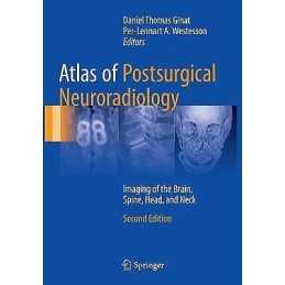 Atlas of Postsurgical Neuroradiology - 9783319848792