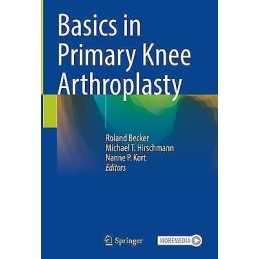 Basics in Primary Knee Arthroplasty - 9783030581770