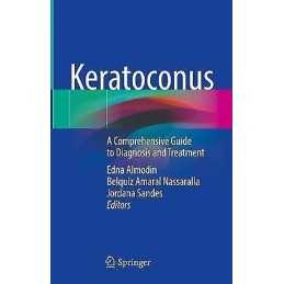 Keratoconus - 9783030853600