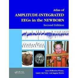 An Atlas of Amplitude-Integrated EEGs in the Newborn - 9781841846491