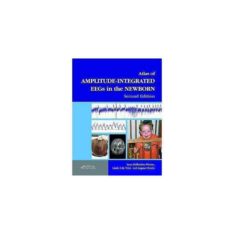 An Atlas of Amplitude-Integrated EEGs in the Newborn - 9781841846491