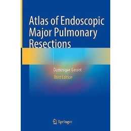 Atlas of Endoscopic Major Pulmonary Resections - 9783030741143