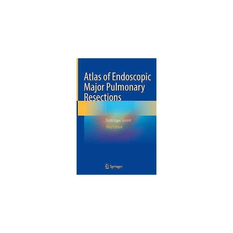 Atlas of Endoscopic Major Pulmonary Resections - 9783030741143