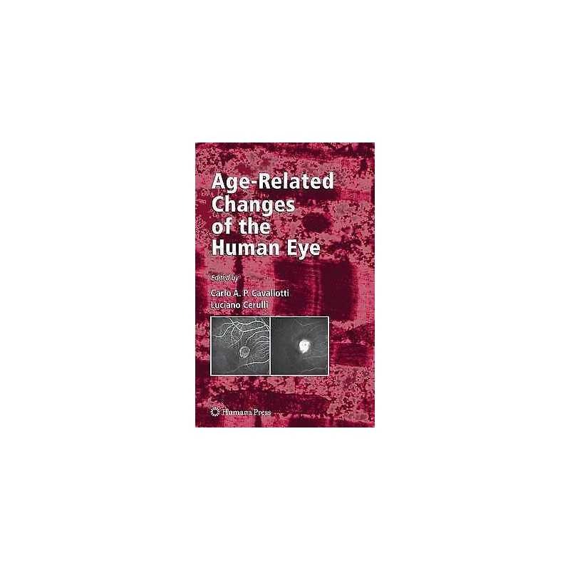 Age-Related Changes of the Human Eye - 9781617379369