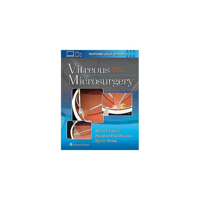 Vitreous Microsurgery - 9781975168353