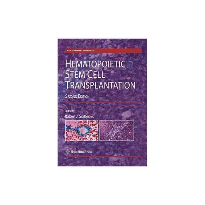 Hematopoietic Stem Cell Transplantation - 9781493956456