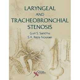 Laryngeal and Tracheobronchial Stenosis - 9781597565509