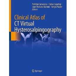 Clinical Atlas of CT Virtual Hysterosalpingography - 9783030662066