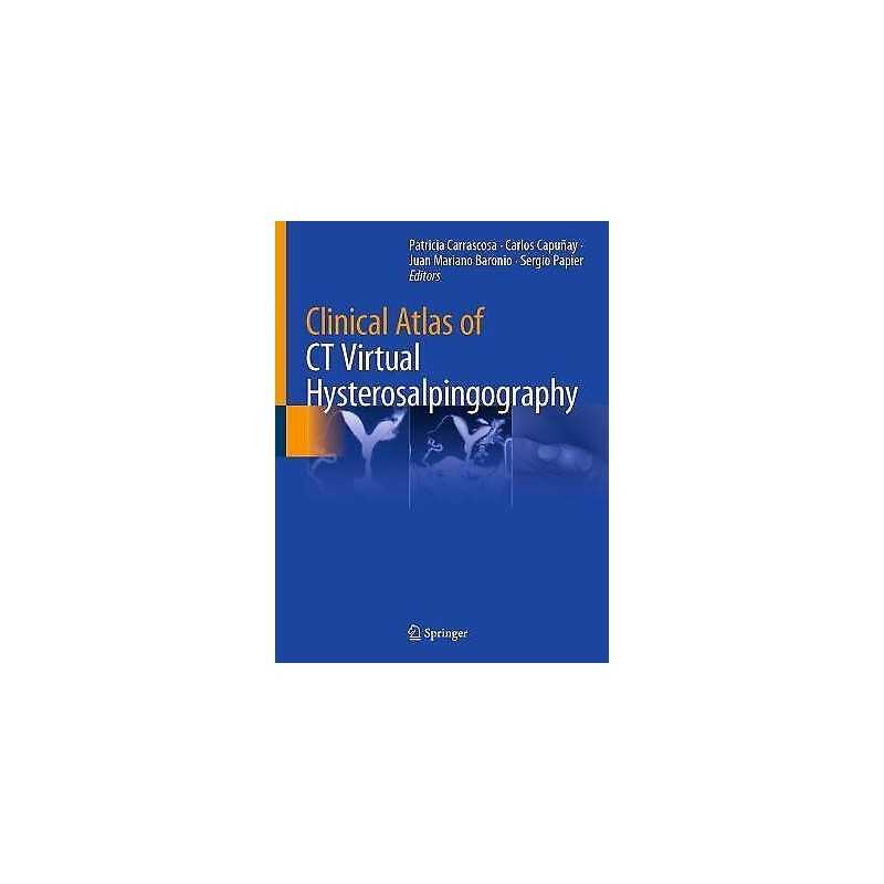 Clinical Atlas of CT Virtual Hysterosalpingography - 9783030662066