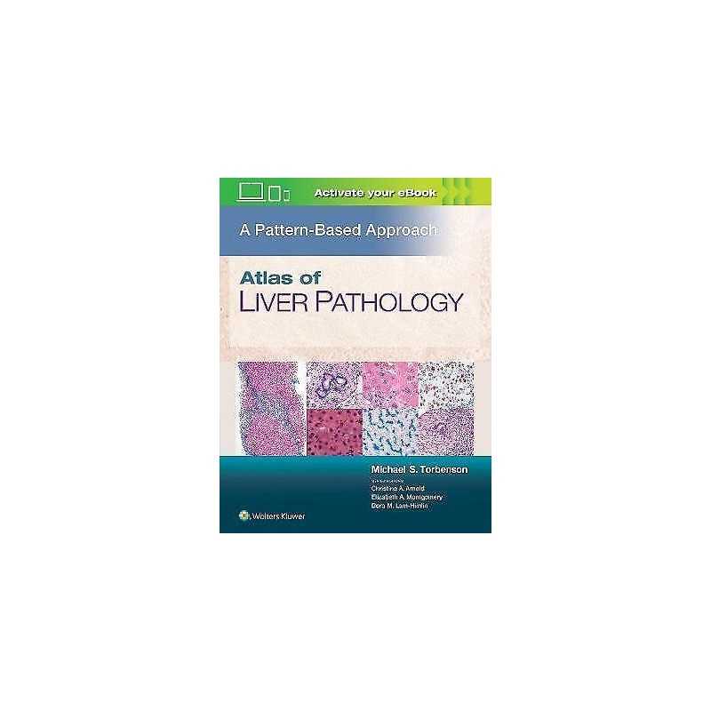 Atlas of Liver Pathology: A Pattern-Based Approach - 9781496396976