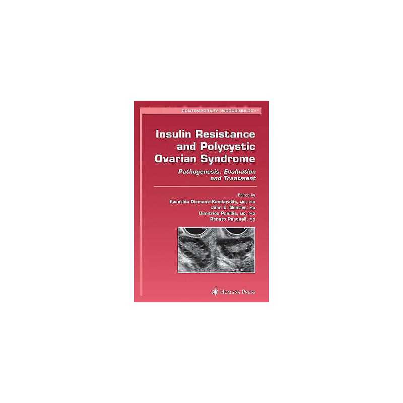 Insulin Resistance and Polycystic Ovarian Syndrome - 9781588297631