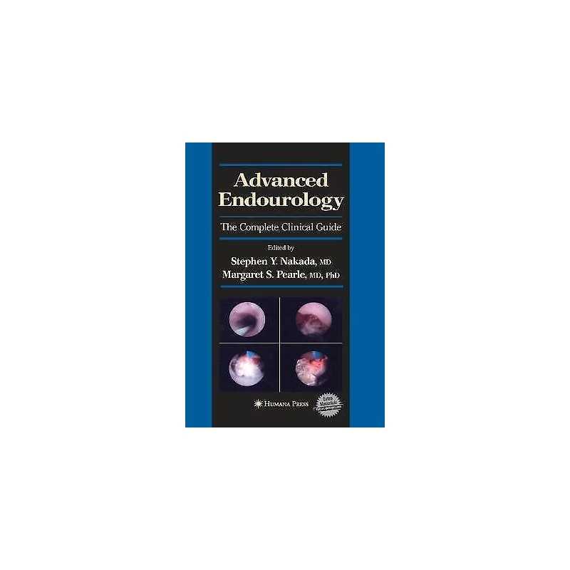 Advanced Endourology - 9781493956784