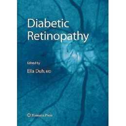 Diabetic Retinopathy - 9781627039215