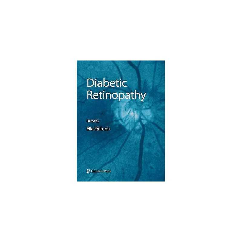 Diabetic Retinopathy - 9781627039215