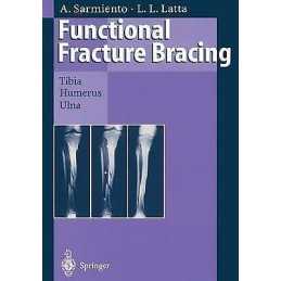 Functional Fracture Bracing - 9783662030950