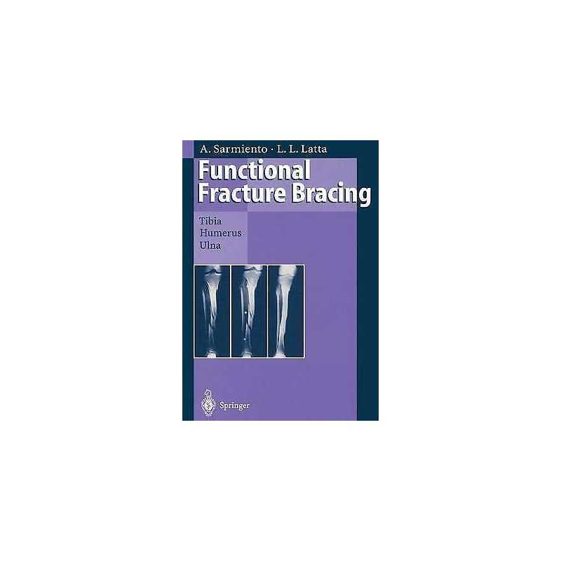 Functional Fracture Bracing - 9783662030950