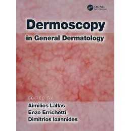 Dermoscopy in General Dermatology - 9781138706569