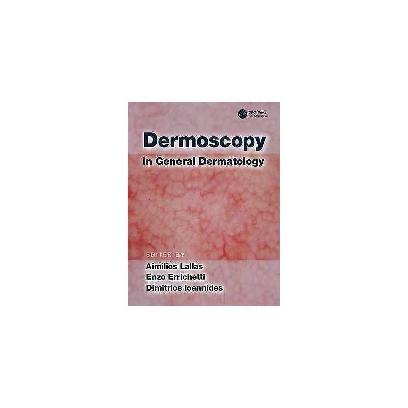 Dermoscopy in General Dermatology - 9781138706569