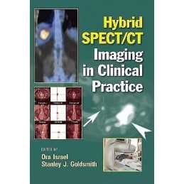 Hybrid SPECT/CT Imaging in Clinical Practice - 9780824728540