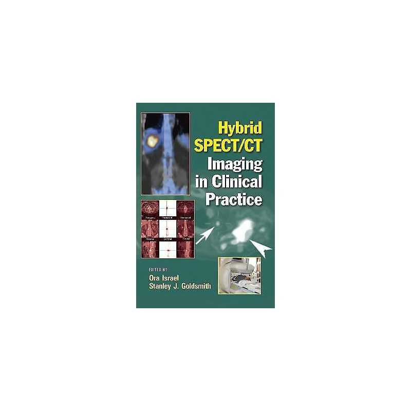 Hybrid SPECT/CT Imaging in Clinical Practice - 9780824728540