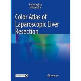 Color Atlas of Laparoscopic Liver Resection - 9789811615450