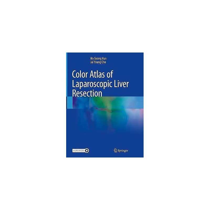 Color Atlas of Laparoscopic Liver Resection - 9789811615450