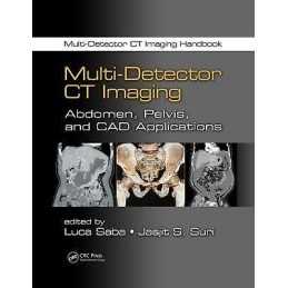 Multi-Detector CT Imaging - 9781439893975