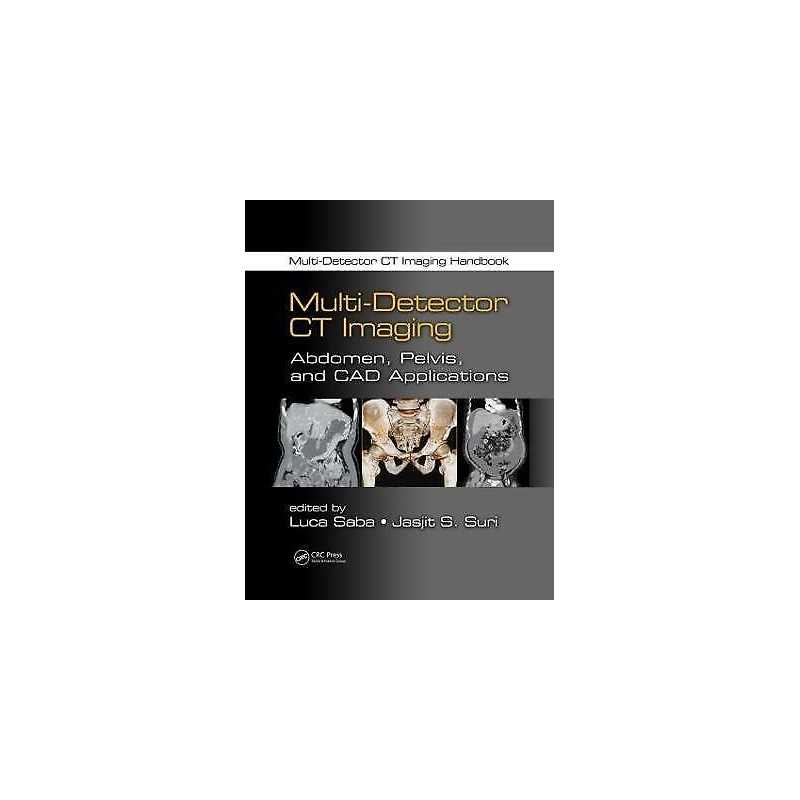 Multi-Detector CT Imaging - 9781439893975