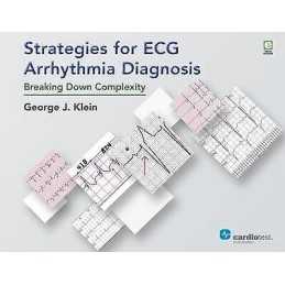 Strategies for ECG Arrhythmia Diagnosis - 9781942909118
