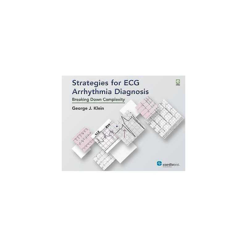 Strategies for ECG Arrhythmia Diagnosis - 9781942909118