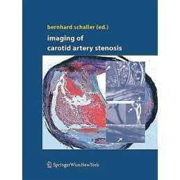 Imaging of Carotid Artery Stenosis - 9783709117415