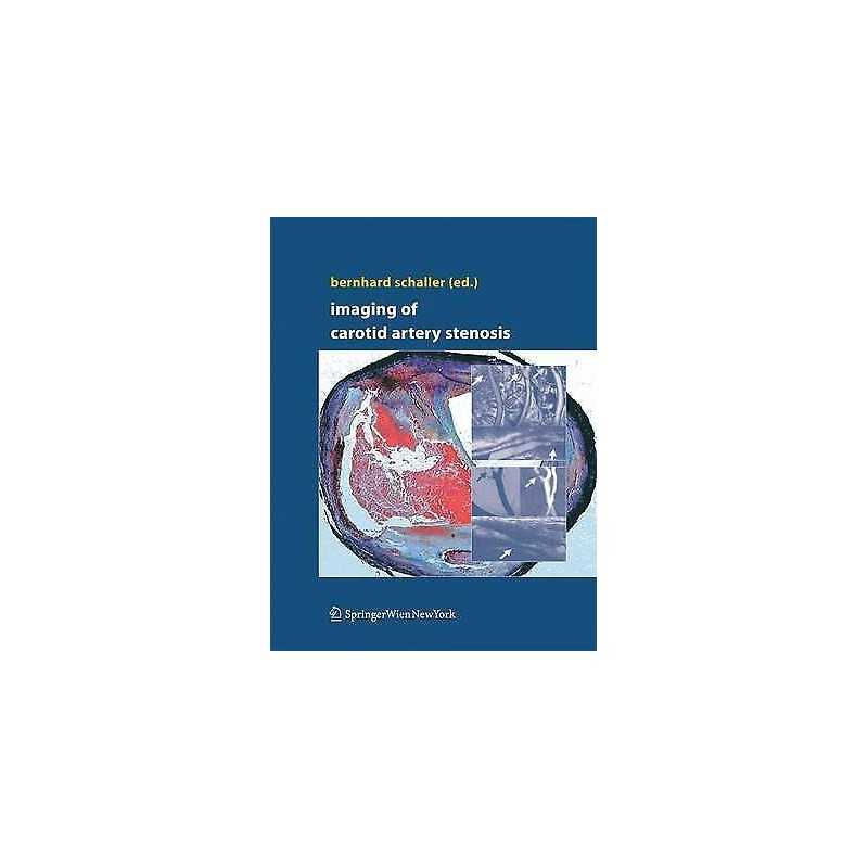 Imaging of Carotid Artery Stenosis - 9783709117415