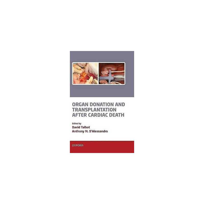 Organ Donation and Transplantation after Cardiac Death - 9780199217335