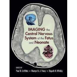 Imaging the Central Nervous System of the Fetus and Neonate - 9780824728564