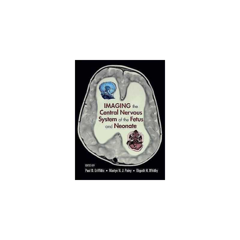Imaging the Central Nervous System of the Fetus and Neonate - 9780824728564
