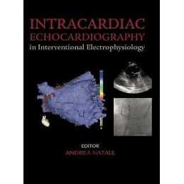 Intracardiac Echocardiography in Interventional Electrophysio... - 9781842143100