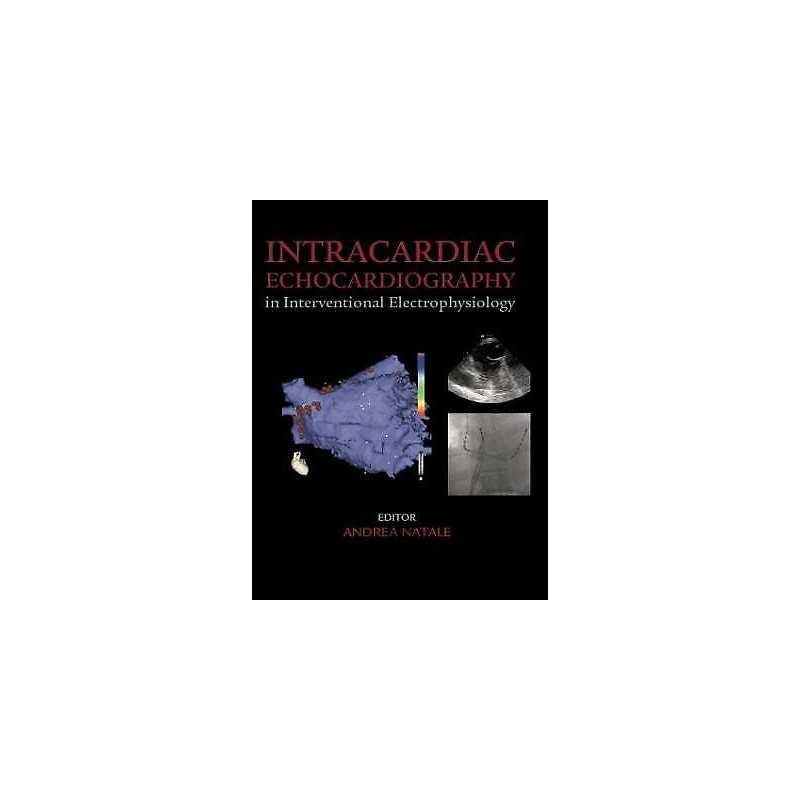 Intracardiac Echocardiography in Interventional Electrophysio... - 9781842143100