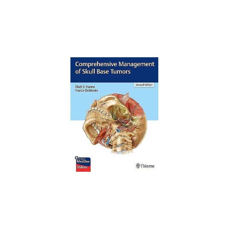 Comprehensive Management of Skull Base Tumors - 9781626235328