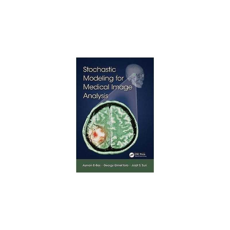 Stochastic Modeling for Medical Image Analysis - 9781466599079