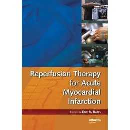 Reperfusion Therapy for Acute Myocardial Infarction - 9780849343582