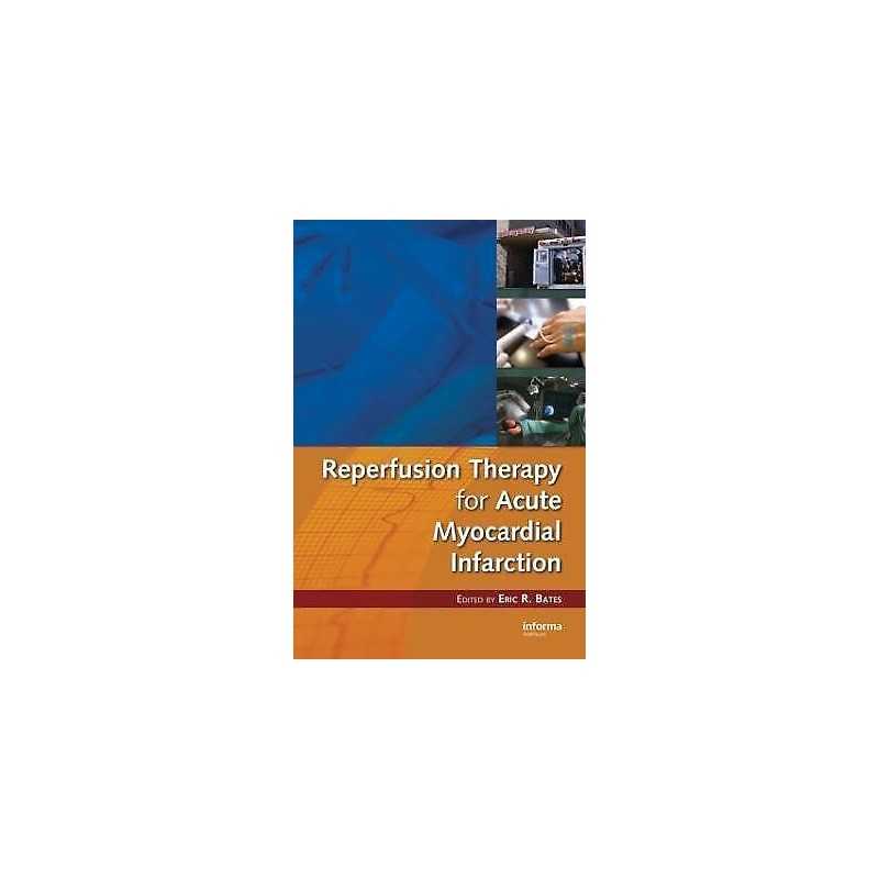 Reperfusion Therapy for Acute Myocardial Infarction - 9780849343582