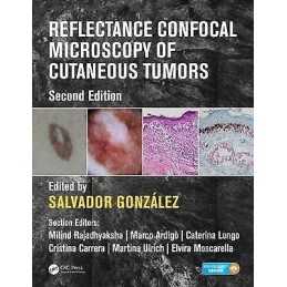 Reflectance Confocal Microscopy of Cutaneous Tumors - 9781498757607