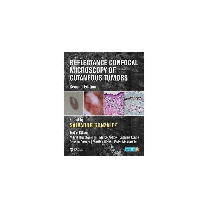 Reflectance Confocal Microscopy of Cutaneous Tumors - 9781498757607