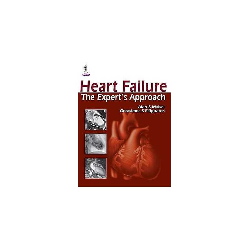 Heart Failure - 9789350909492