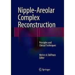 Nipple-Areolar Complex Reconstruction - 9783319609249