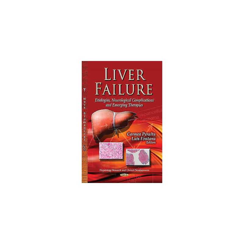 Liver Failure - 9781628085075