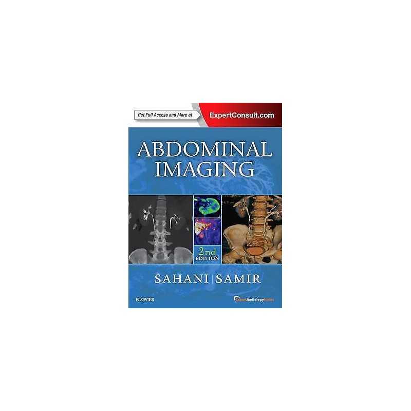 Abdominal Imaging - 9780323377980