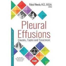 Pleural Effusions - 9781536146837